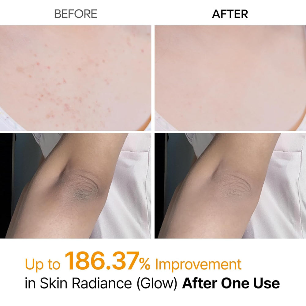 Dr. Melaxin peel Shot - For Dark Spots, Rough & Bumpy Skin [200ml]