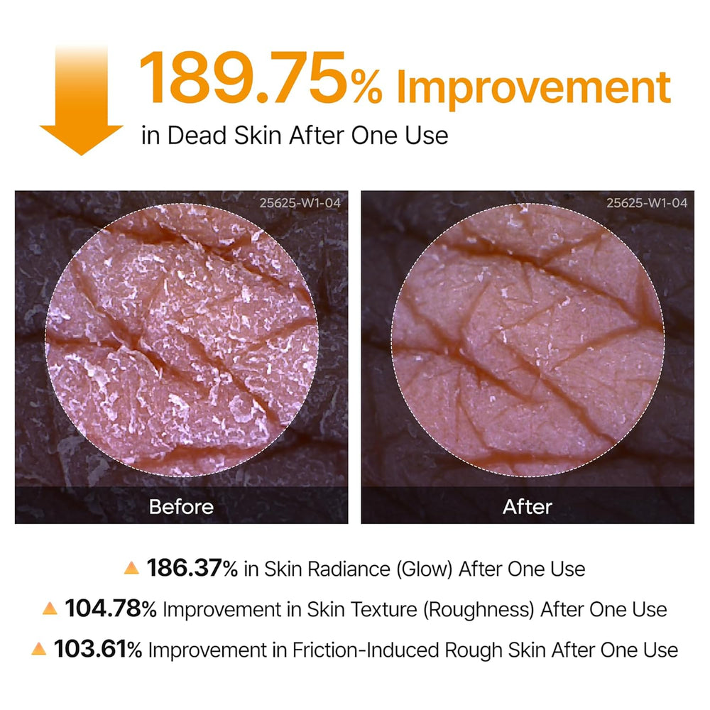 Dr. Melaxin peel Shot - For Dark Spots, Rough & Bumpy Skin [200ml]