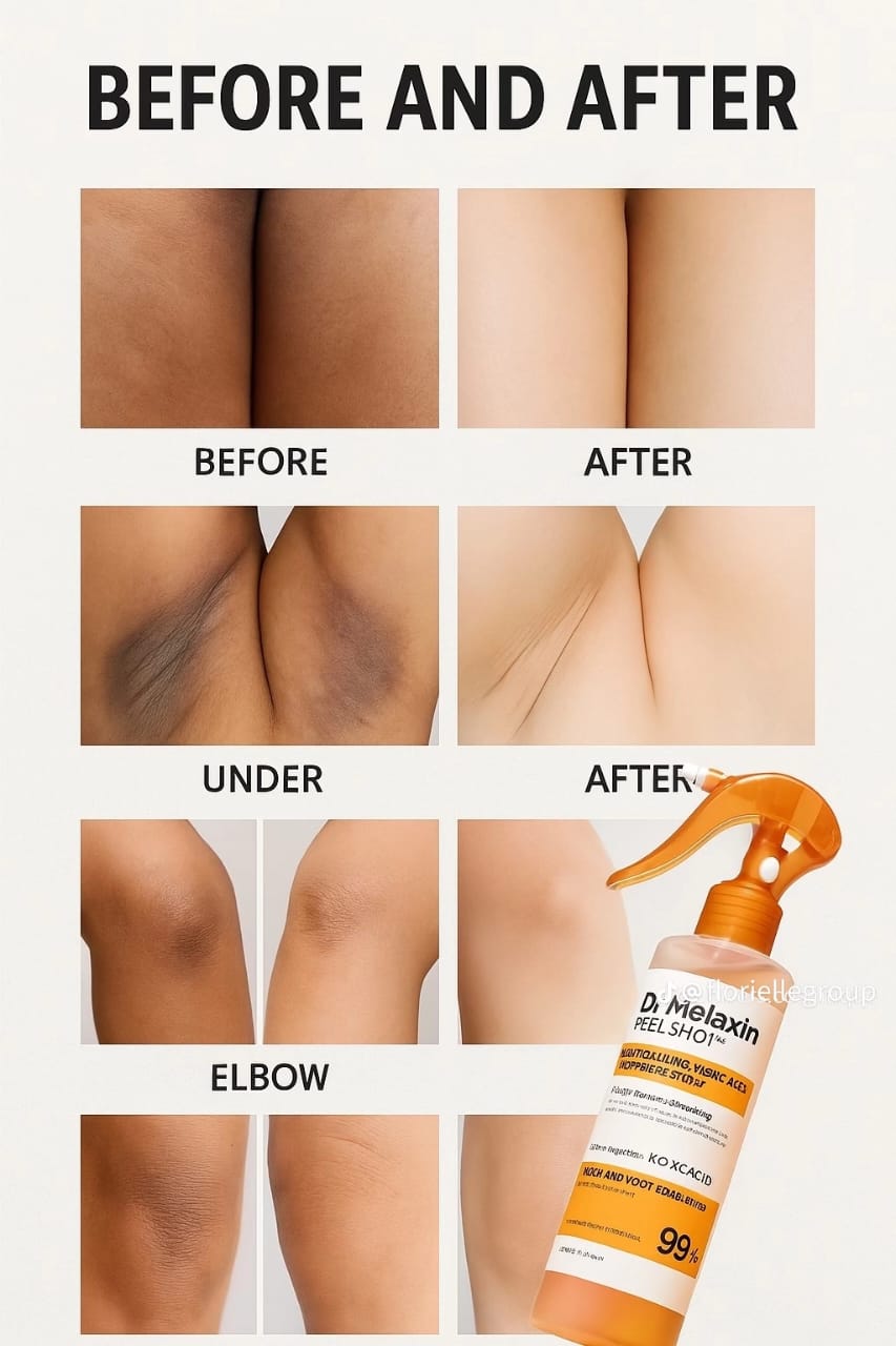 Dr. Melaxin peel Shot - For Dark Spots, Rough & Bumpy Skin [200ml]